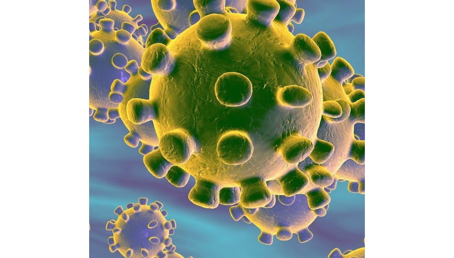 De 2019-nCoV à Covid-19, le nouveau coronavirus change de nom