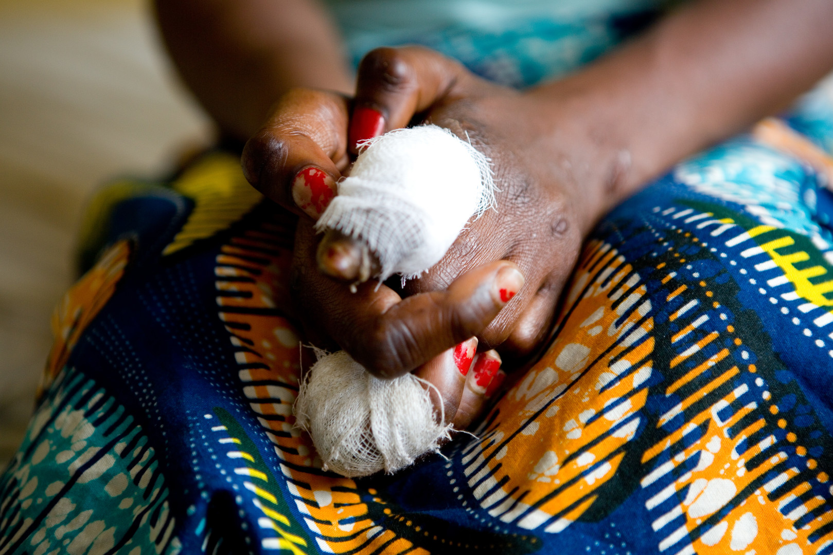 Better testing boosts leprosy response in the Democratic Republic of the Congo