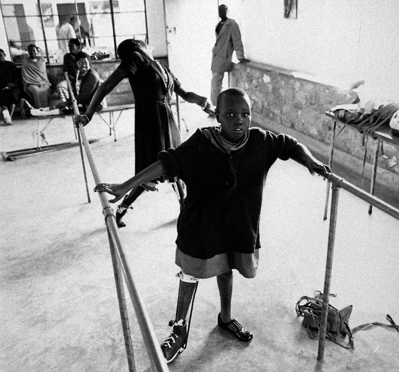 A young polio survivor in Kenya undergoes rehabilitation, 1980 ©WHO