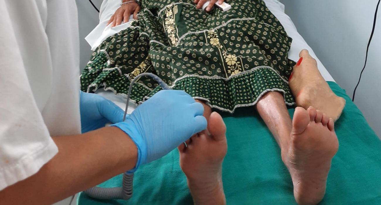 Mauritian clinics help cut diabetic foot amputations