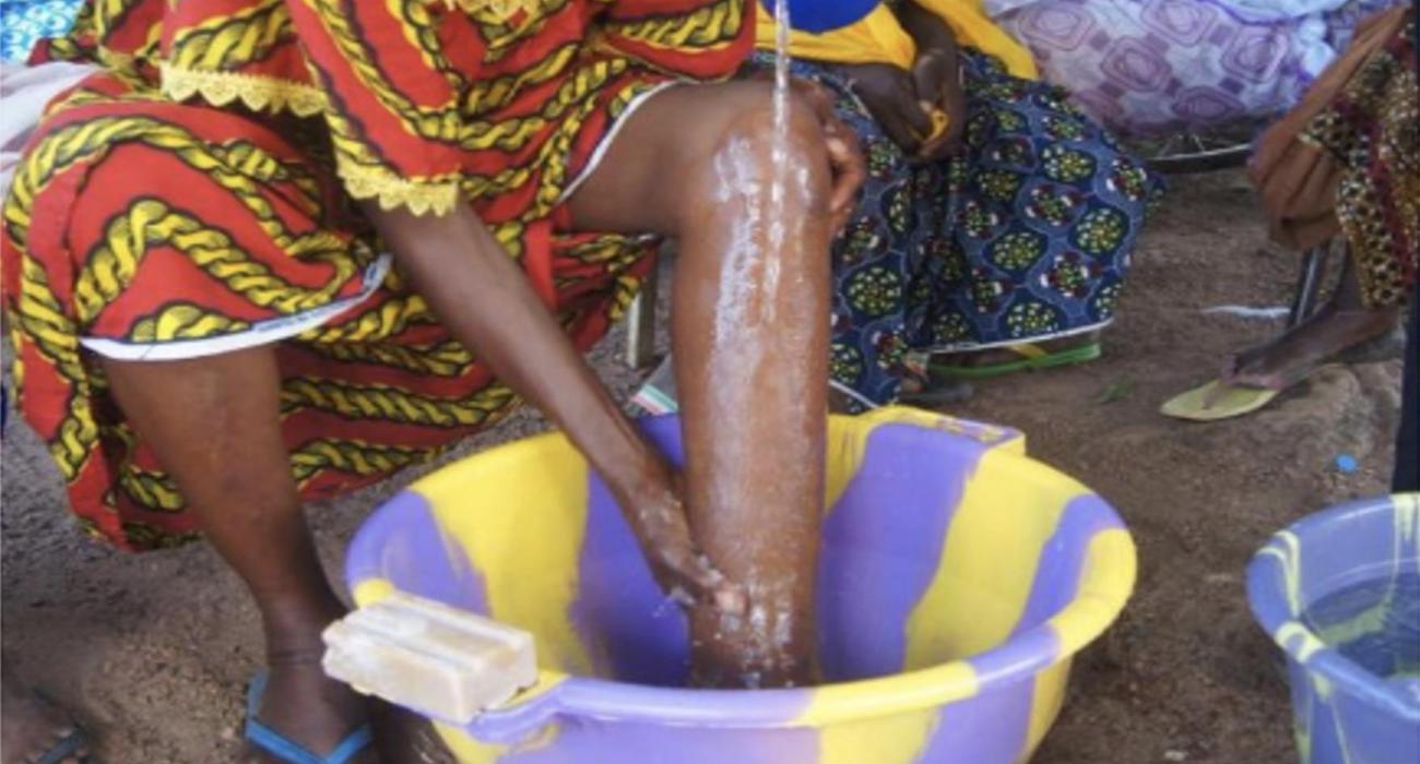 Le Cameroun sur la voie de l’élimination de l’éléphantiasis