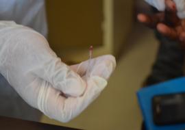 Rapid test for Hepatitis E at the point of care 