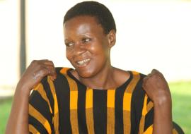 Minsa Bakimenze displays Leprosy sore on her hands