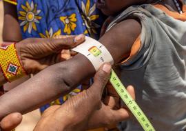 Screened for malnutrition by a mobile health team