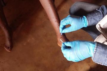 Scaling up response tåo curb growing mpox outbreak in African region