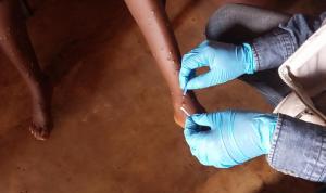 Scaling up response tåo curb growing mpox outbreak in African region