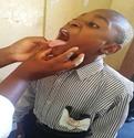 A child being examined for oral hygiene