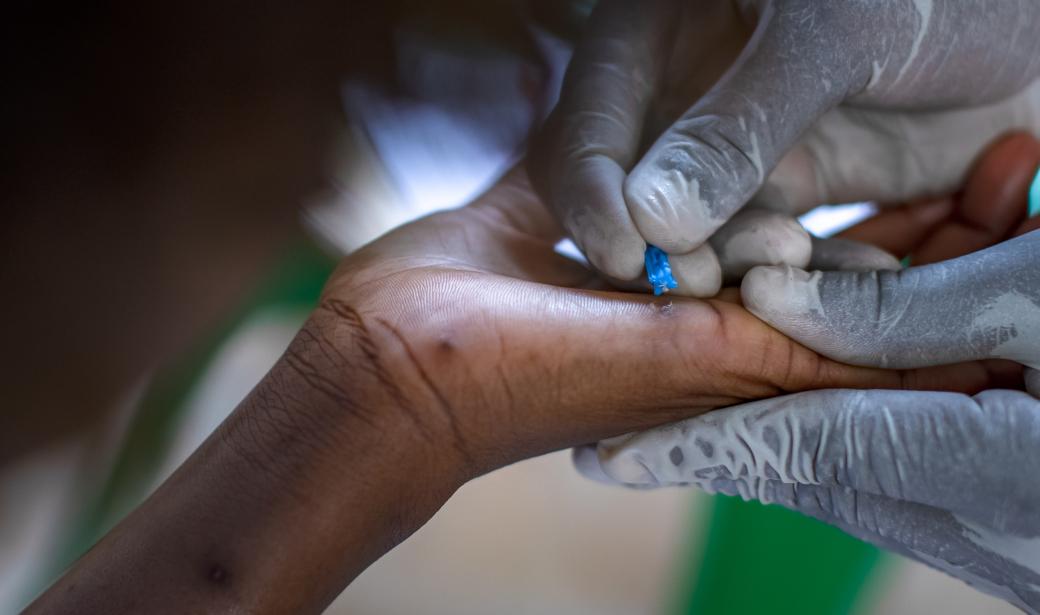 Reinforcing outbreak response systems to curb mpox in Uganda